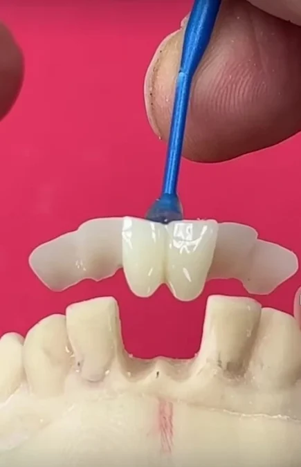 Maryland Bridge Dental